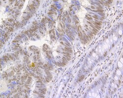 Histone H3 (acetyl K27) Polyclonal Antibody, Huabio 100 &mu;L; Unconjugated:Antibodies,
