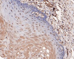 CDKN1A/P21 Polyclonal Antibody, Huabio 100 &mu;L; Unconjugated:Antibodies,