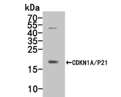 CDKN1A/P21 Polyclonal Antibody, Huabio 100 &mu;L; Unconjugated:Antibodies,