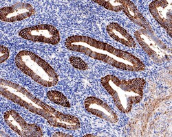 Monocarboxylic acid transporter 1 Polyclonal Antibody, Huabio 100 &mu;L;