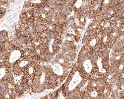 Monocarboxylic acid transporter 1 Polyclonal Antibody, Huabio 100 &mu;L;