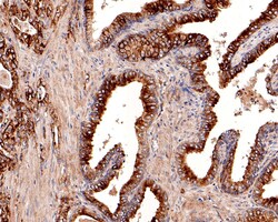 Monocarboxylic acid transporter 1 Polyclonal Antibody, Huabio 100 &mu;L;