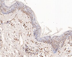 DP2 Polyclonal Antibody, Huabio 100 &mu;L; Unconjugated:Antibodies, Polyclonal