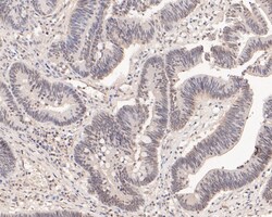 DP2 Polyclonal Antibody, Huabio 100 &mu;L; Unconjugated:Antibodies, Polyclonal