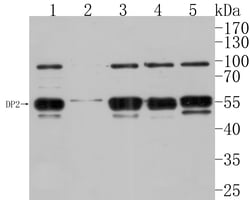 DP2 Polyclonal Antibody, Huabio 100 &mu;L; Unconjugated:Antibodies, Polyclonal