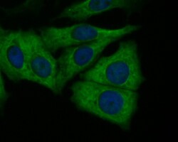Butyrylcholine esterase Polyclonal Antibody, Huabio 100 &mu;L; Unconjugated:Antibodies,