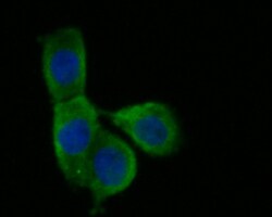 Butyrylcholine esterase Polyclonal Antibody, Huabio 100 &mu;L; Unconjugated:Antibodies,