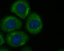 Butyrylcholine esterase Polyclonal Antibody, Huabio 100 &mu;L; Unconjugated:Antibodies,