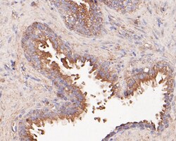 Butyrylcholine esterase Polyclonal Antibody, Huabio 100 &mu;L; Unconjugated:Antibodies,