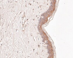 Butyrylcholine esterase Polyclonal Antibody, Huabio 100 &mu;L; Unconjugated:Antibodies,