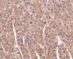 Butyrylcholine esterase Polyclonal Antibody, Huabio 100 &mu;L; Unconjugated:Antibodies,
