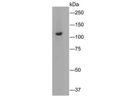 Butyrylcholine esterase Polyclonal Antibody, Huabio 100 &mu;L; Unconjugated:Antibodies,