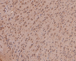 NMBR Polyclonal Antibody, Huabio 100 &mu;L; Unconjugated:Antibodies, Polyclonal