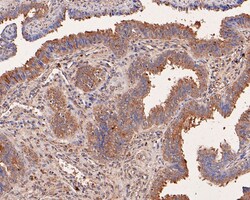 NMBR Polyclonal Antibody, Huabio 100 &mu;L; Unconjugated:Antibodies, Polyclonal