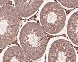 NMBR Polyclonal Antibody, Huabio 100 &mu;L; Unconjugated:Antibodies, Polyclonal