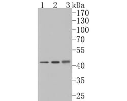 NMBR Polyclonal Antibody, Huabio 100 &mu;L; Unconjugated:Antibodies, Polyclonal