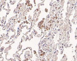 MVD Polyclonal Antibody, Huabio 100 &mu;L; Unconjugated:Antibodies, Polyclonal