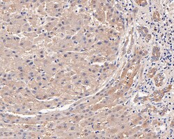 MVD Polyclonal Antibody, Huabio 100 &mu;L; Unconjugated:Antibodies, Polyclonal