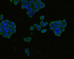 CCR3 Polyclonal Antibody, Huabio 100 &mu;L; Unconjugated:Antibodies, Polyclonal