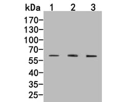 CCR3 Polyclonal Antibody, Huabio 100 &mu;L; Unconjugated:Antibodies, Polyclonal
