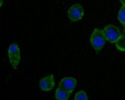 CPN1 Polyclonal Antibody, Huabio 100 &mu;L; Unconjugated:Antibodies, Polyclonal