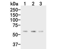 CPN1 Polyclonal Antibody, Huabio 100 &mu;L; Unconjugated:Antibodies, Polyclonal
