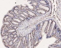SOX17 Polyclonal Antibody, Huabio 100 &mu;L; Unconjugated:Antibodies, Polyclonal
