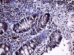 HABP2 Monoclonal Antibody (OTI5H3), TrueMAB , OriGene 100 &mu;L; Unconjugated:Antibodies,