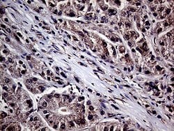 HABP2 Monoclonal Antibody (OTI5H3), TrueMAB , OriGene 100 &mu;L; Unconjugated:Antibodies,