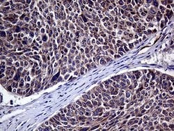 HABP2 Monoclonal Antibody (OTI5H3), TrueMAB , OriGene 100 &mu;L; Unconjugated:Antibodies,