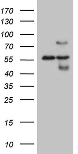 HABP2 Mouse anti-Human, Clone: OTI8D6, lyophilized, TrueMAB 100 &mu;g;
