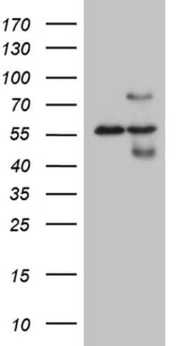 HABP2 Monoclonal Antibody (OTI8D6), TrueMAB , OriGene 100 &mu;L; Unconjugated:Antibodies,