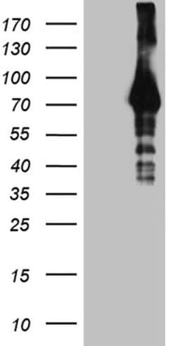 HABP2 Monoclonal Antibody (OTI4G9), TrueMAB , OriGene 30 &mu;L; Unconjugated:Antibodies,