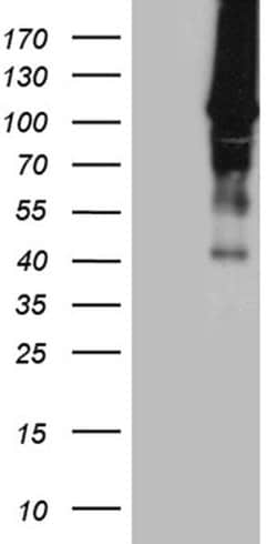 HACE1 Monoclonal Antibody (OTI4E10), TrueMAB , OriGene 100 &mu;L; Unconjugated:Antibodies,