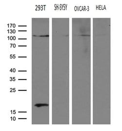 HACE1 Monoclonal Antibody (OTI4E10), TrueMAB , OriGene 100 &mu;L; Unconjugated:Antibodies,