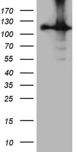 HACE1 Monoclonal Antibody (OTI2C7), TrueMAB , OriGene:Antibodies:Primary