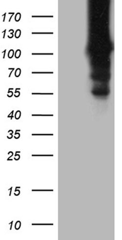 HACE1 Monoclonal Antibody (OTI6H8), TrueMAB , OriGene 100 &mu;L; Unconjugated:Antibodies,