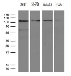HACE1 Mouse anti-Human, Clone: OTI6H8, lyophilized, TrueMAB 100 &mu;g;