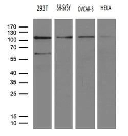 HACE1 Monoclonal Antibody (OTI6H8), TrueMAB , OriGene 100 &mu;L; Unconjugated:Antibodies,