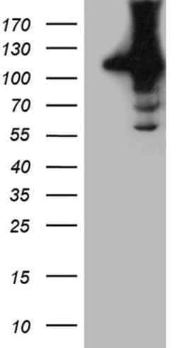HACE1 Monoclonal Antibody (OTI10D3), TrueMAB , OriGene:Antibodies:Primary