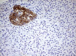 HADH Mouse anti-Human, Clone: OTI3D12, lyophilized, TrueMAB 100 &mu;g;
