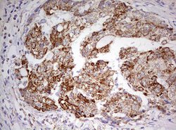 HADH Mouse anti-Human, Clone: OTI3D12, lyophilized, TrueMAB 100 &mu;g;