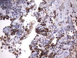HADH Mouse anti-Human, Clone: UMAB151, liquid, UltraMAB 30 &mu;L; Unconjugated:Antibodies,