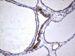 HADH Mouse anti-Human, Clone: UMAB151, liquid, UltraMAB 30 &mu;L; Unconjugated:Antibodies,