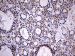 HADH Mouse anti-Human, Clone: UMAB151, liquid, UltraMAB 30 &mu;L; Unconjugated:Antibodies,