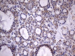 HADH Mouse anti-Human, Clone: UMAB151, lyophilized, UltraMAB 100 &mu;g;