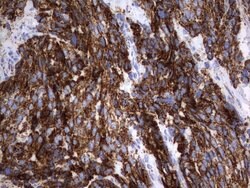 HADH Mouse anti-Human, Clone: UMAB151, liquid, UltraMAB 30 &mu;L; Unconjugated:Antibodies,