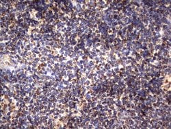 HADH Mouse anti-Human, Clone: UMAB151, lyophilized, UltraMAB 100 &mu;g;
