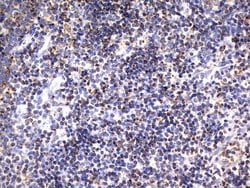 HADH Mouse anti-Human, Clone: UMAB151, liquid, UltraMAB 30 &mu;L; Unconjugated:Antibodies,