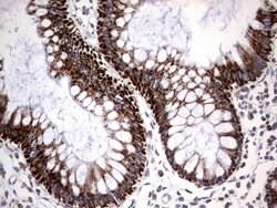 HADH Mouse anti-Human, Clone: UMAB151, lyophilized, UltraMAB 100 &mu;g;